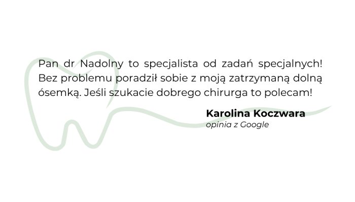 opinie z google (2)